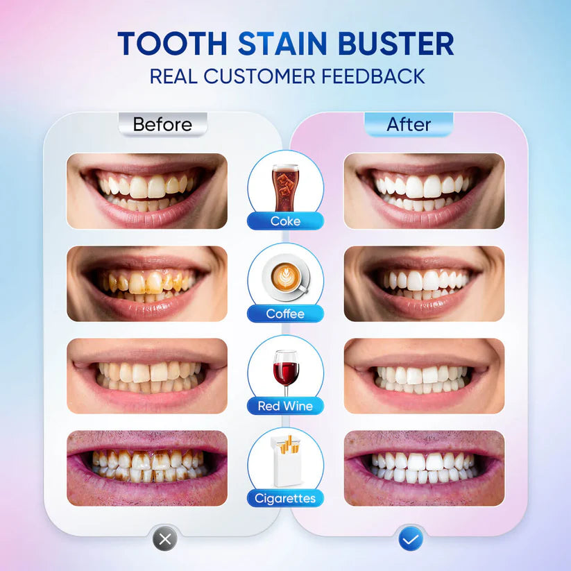 Body Accel Whitening Toothpaste