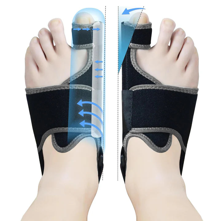 Neoprene Adjustable Bunion Toe Corrector
