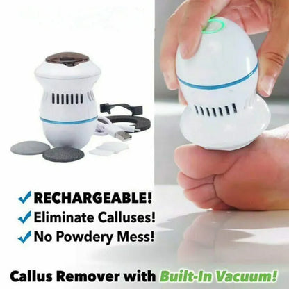 Electric Feet Callus Remover