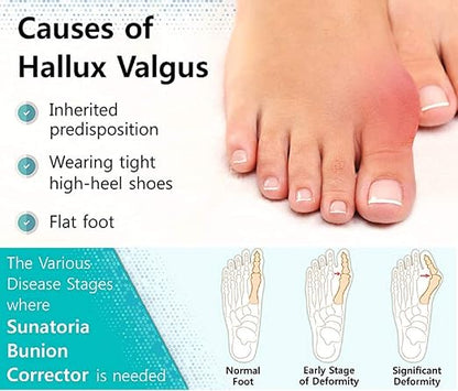 Toe Bunion Guards