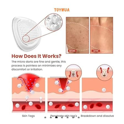 Derma Smooth Skin (72) Patches