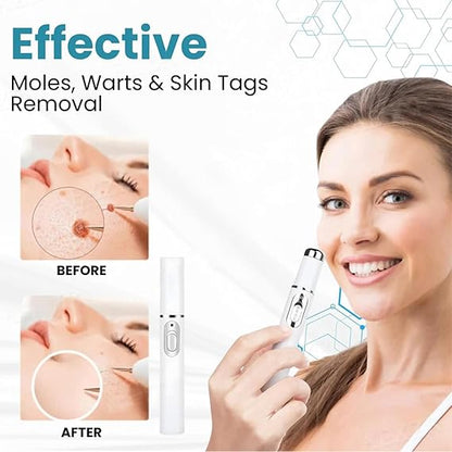 Mole and Wart Removal Pen