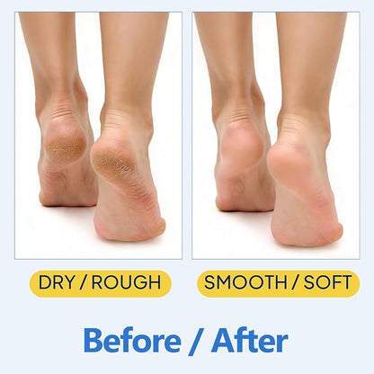 Hydrating Foot Cream Stick