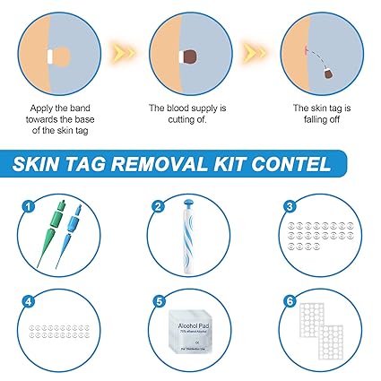 Stielwarts Removal Quick Kit