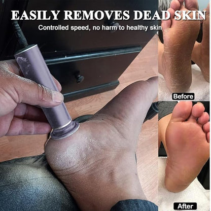 Electric Foot File Hard Skin Remover