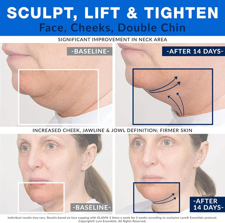 Facial Cupping Set for Skin Uplifting and tightning