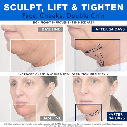 Facial Cupping Set for Skin Uplifting and tightning